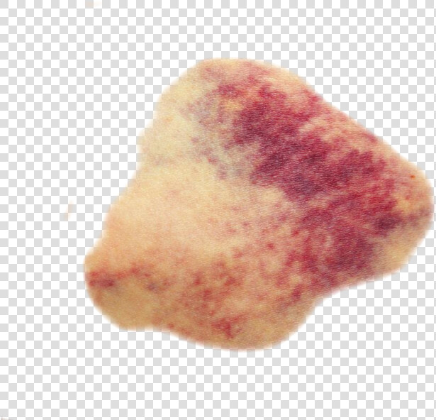 Transparent Bruise  HD Png DownloadTransparent PNG
