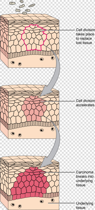 418 Development Of Cancer   Tissue And A Cell Diagram  HD Png DownloadTransparent PNG