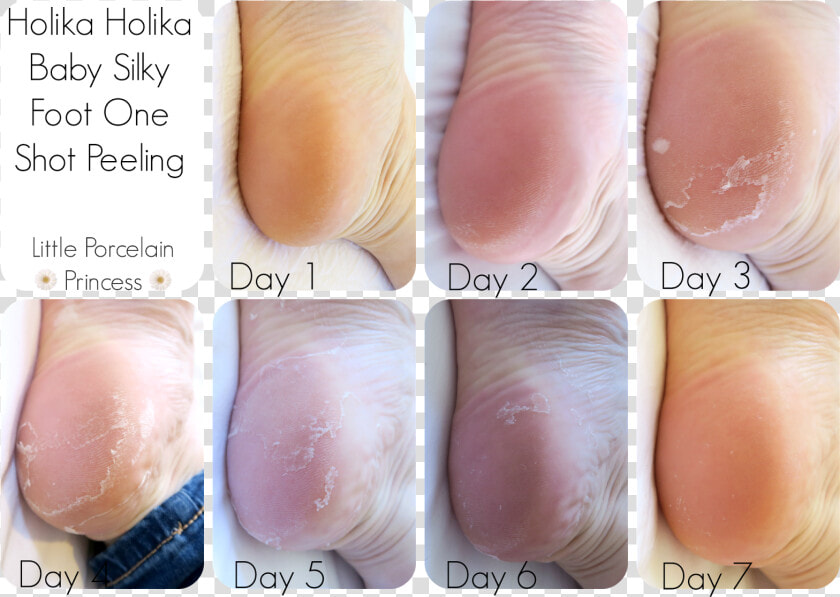 My Feet Did Peel Lightly For A Couple Of Days After   Skin Republic Foot Peel Review  HD Png DownloadTransparent PNG