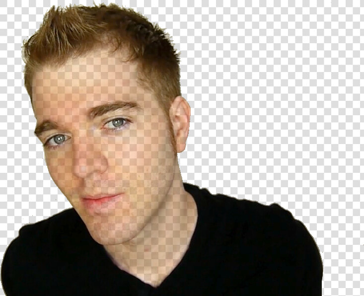 “ Transparent Shane Dawson Www   Shane Dawson Before After  HD Png DownloadTransparent PNG