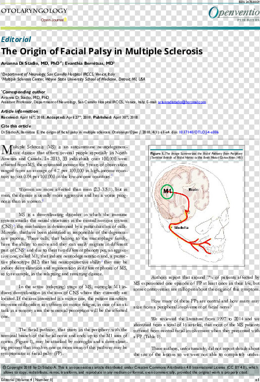 Multiple Sclerosis Facial Palsy  HD Png DownloadTransparent PNG