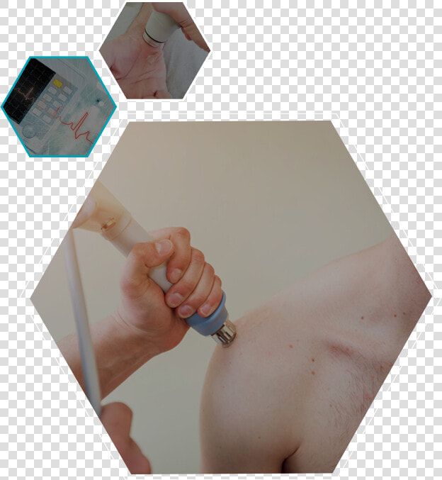 Shock Wave Therapy   Art  HD Png DownloadTransparent PNG