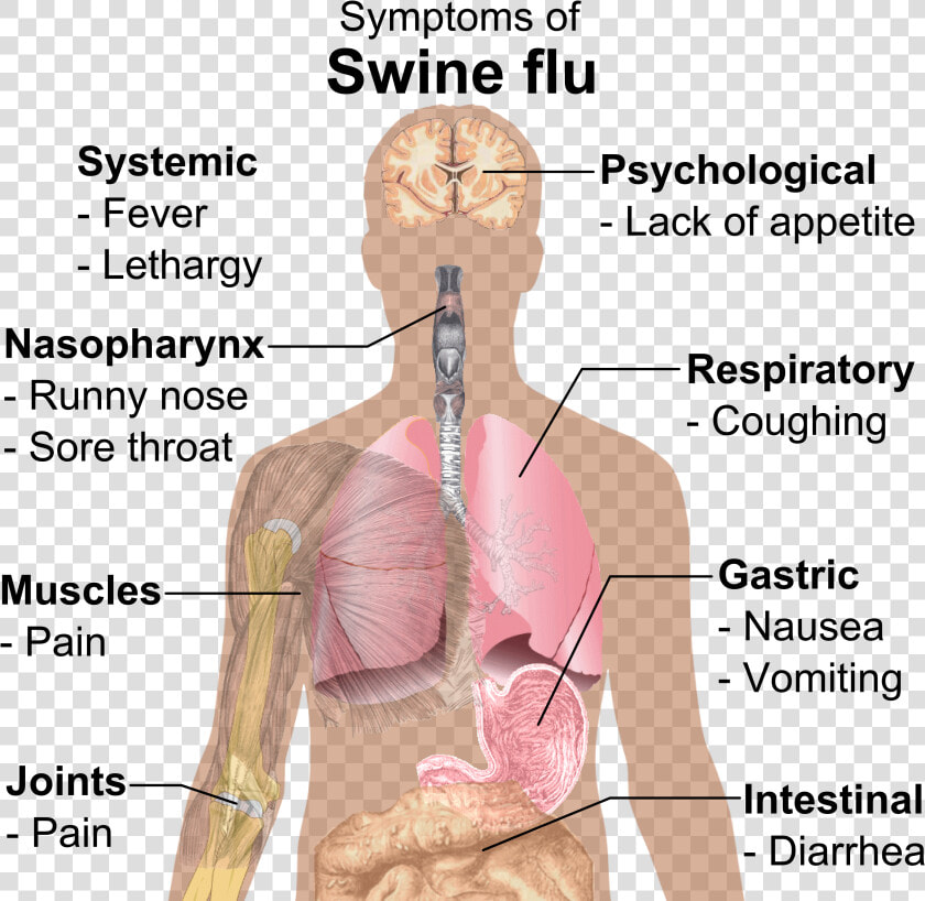 Symptoms Of Swine Flu   Swine Flu Symptoms  HD Png DownloadTransparent PNG