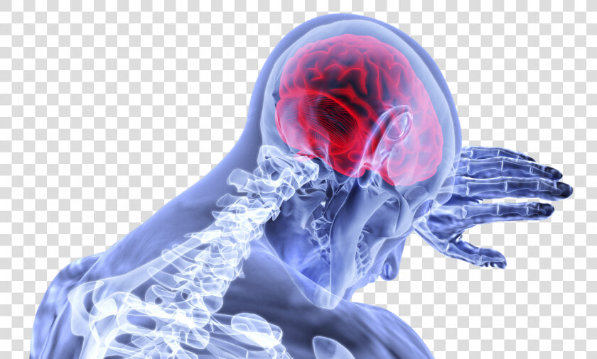 Concussion Brain Png  Transparent PngTransparent PNG