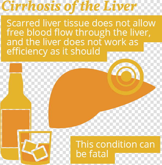 Cirrhosis And Alcohol Use  HD Png DownloadTransparent PNG