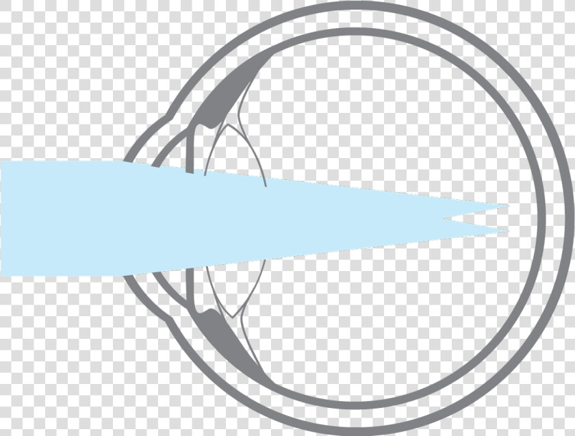 Myopia Vector  HD Png DownloadTransparent PNG