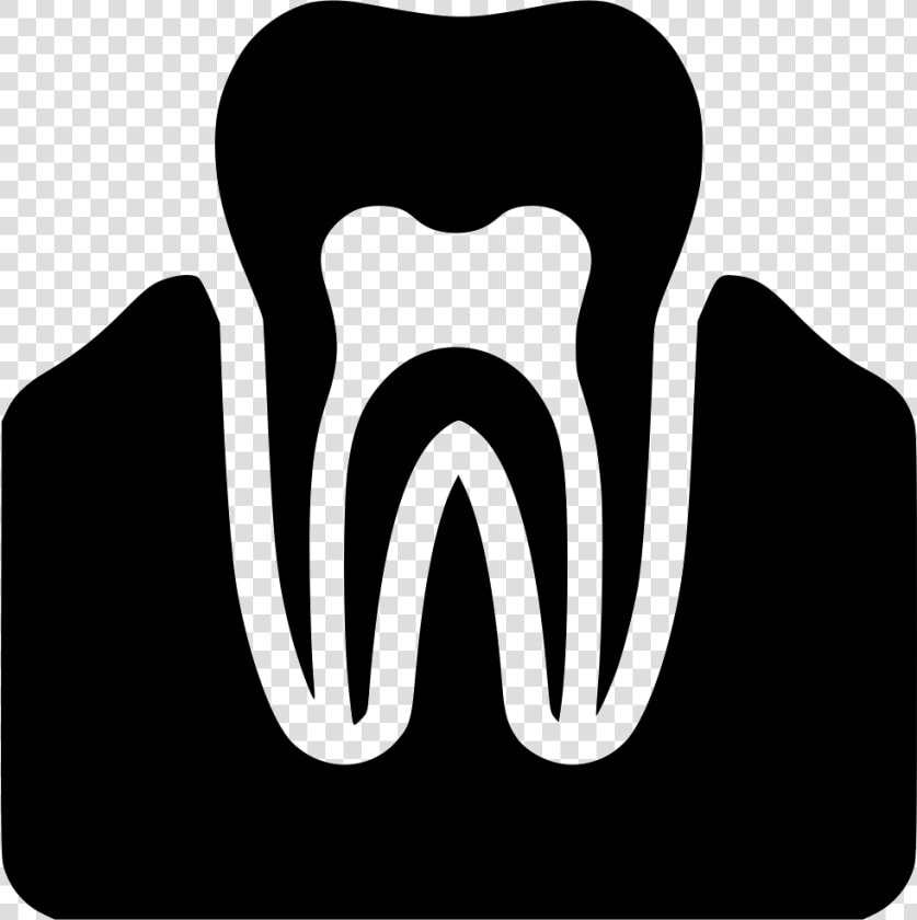 Gum Nerves  HD Png DownloadTransparent PNG