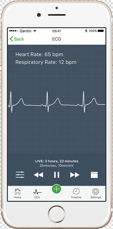 How To Read An Electrocardiogram   Atrial Fibrillation Holter Monitor  HD Png DownloadTransparent PNG