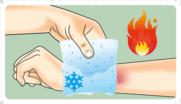 Ill Burn Gel Dressing   Burns Treatment  HD Png DownloadTransparent PNG