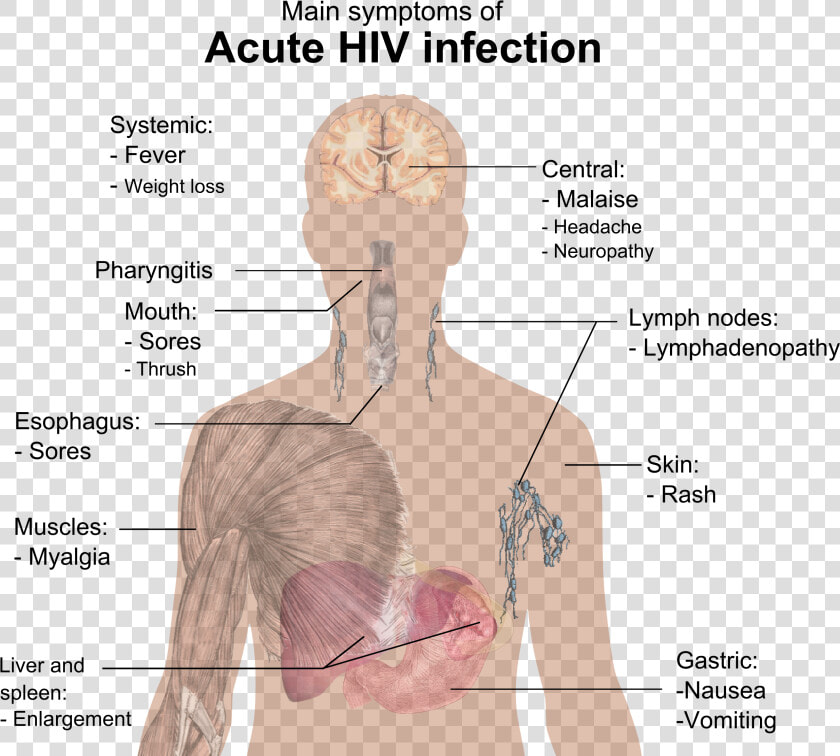 Symptoms Of Acute Hiv Infection   Hiv Symptoms  HD Png DownloadTransparent PNG