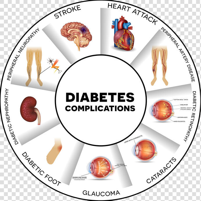 48739704 S   Complications Of Diabetes Poster  HD Png DownloadTransparent PNG