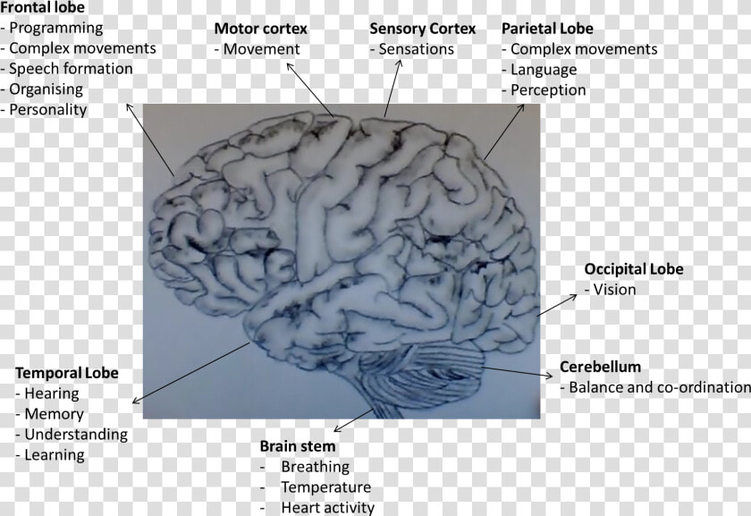 Functions Of Areas Of The Human Brain   Human Brain With Dementia  HD Png DownloadTransparent PNG