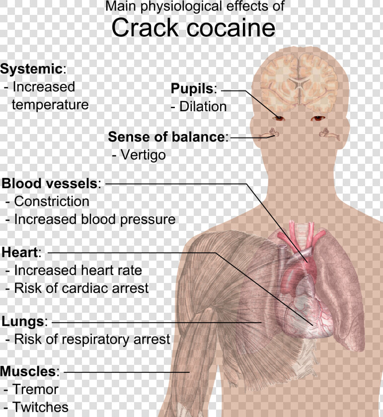 Physiological Effects Of Crack Cocaine   Crack Does To Your Body  HD Png DownloadTransparent PNG