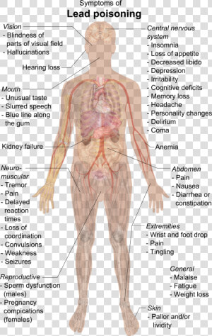 Symptoms Of Lead Poisoning   Lead Poisoning Symptoms  HD Png Download