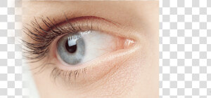 Eye Surgery In New Jersey   Treat Chicken Skin Under Eyes  HD Png Download