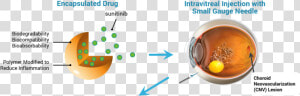 Intravitreal Injection  HD Png Download