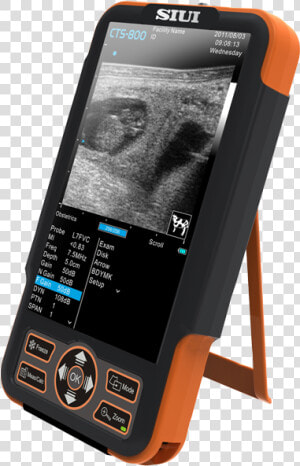 Siui Ultrasound Sts 800  HD Png Download