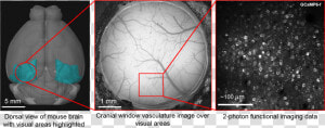 Png File Surgery   Visual Cortex Mouse Brain Cranial  Transparent Png