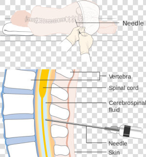 Diagram Showing A Lumbar Puncture   Lumbar Puncture Depth  HD Png Download
