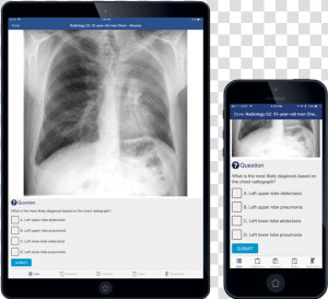 Module   Title   X ray  HD Png Download