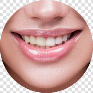 Charcoal Blast Teeth Whitening Powder Reviews  HD Png Download
