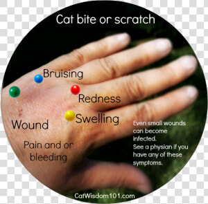 Cat Bite scratch Pasteurella   Cat Bite Vs Scratch  HD Png Download