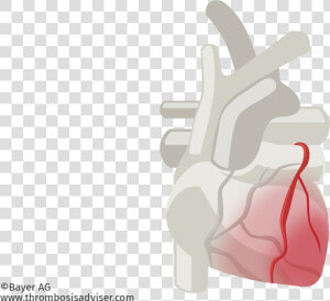 Cardiac Muscle Damage In Acs   Illustration  HD Png Download