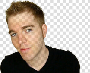 “ Transparent Shane Dawson Www   Shane Dawson Before After  HD Png Download