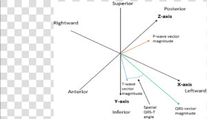 Superior Axis P Wave  HD Png Download
