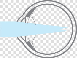 Myopia Vector  HD Png Download