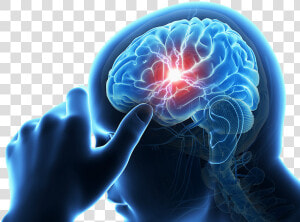 Risk Carotid Stroke Chiropractic Care   Brain Stroke Png Clipart  Transparent Png