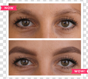 Patchy Eyebrows  HD Png Download