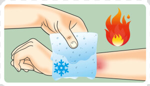 Ill Burn Gel Dressing   Burns Treatment  HD Png Download