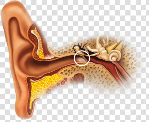 Calcification Of Ear Canal  HD Png Download
