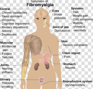 Woman Fibromyalgia Trigger Points  HD Png Download