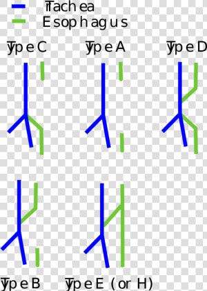 Te Fistula Types  HD Png Download