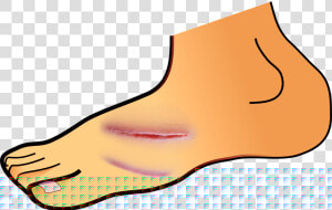 Transparent Wound Clipart   Cuts And Scrapes Clipart  HD Png Download