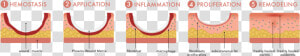 Renovoderm Phoenix The Healing Process   Pattern  HD Png Download