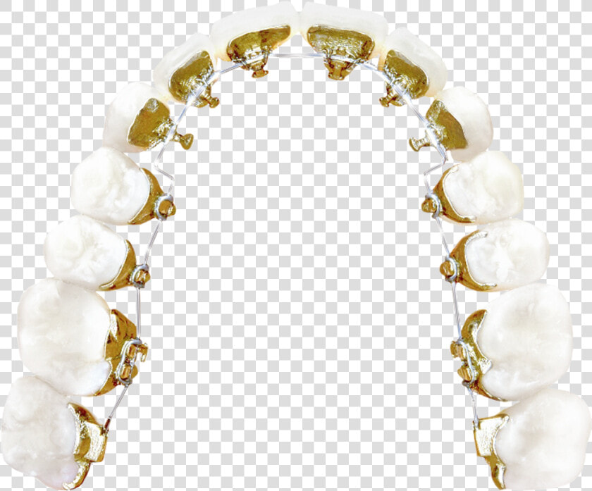 Lingual Braces   Pearl  HD Png DownloadTransparent PNG