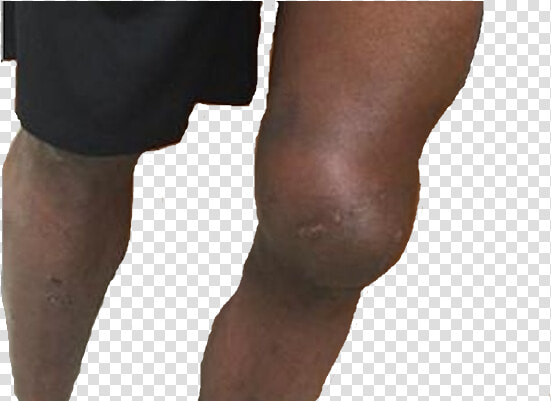High Quality Knee Grow Blank Meme Template   Tights  HD Png DownloadTransparent PNG