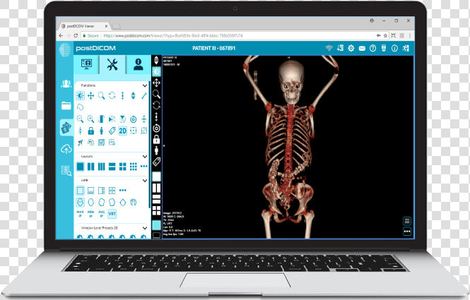 Notebook   Netbook  HD Png DownloadTransparent PNG