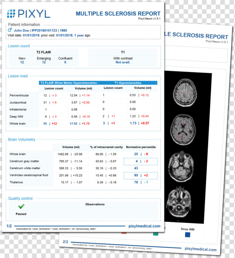 Reports Of Multiple Sclerosis  HD Png DownloadTransparent PNG