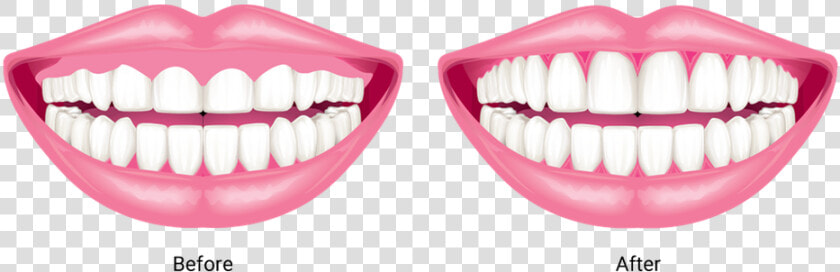 Gum Drawing Front Tooth   Gums  HD Png DownloadTransparent PNG