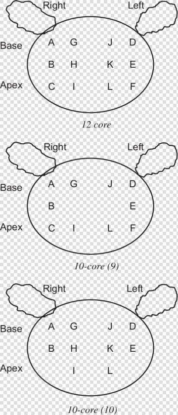 Left Lateral Apex Prostate  HD Png DownloadTransparent PNG
