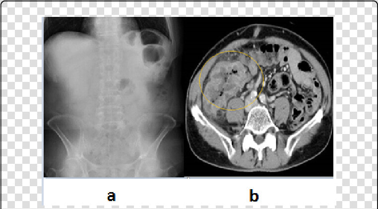 Computed Tomography  HD Png DownloadTransparent PNG
