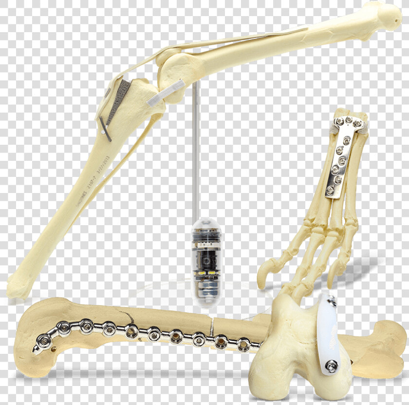 All Categories Mmo  Sop  Ridgestop  Carpal Arthrodesis    Figurine  HD Png DownloadTransparent PNG