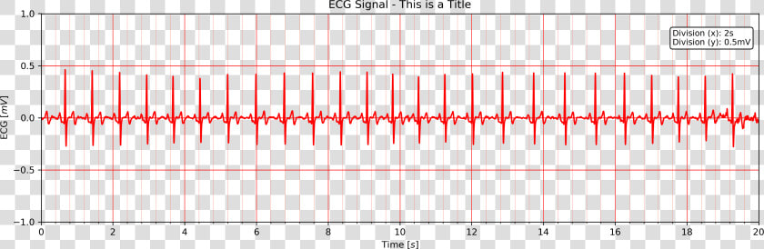             Images ecg20title   Plot  HD Png DownloadTransparent PNG